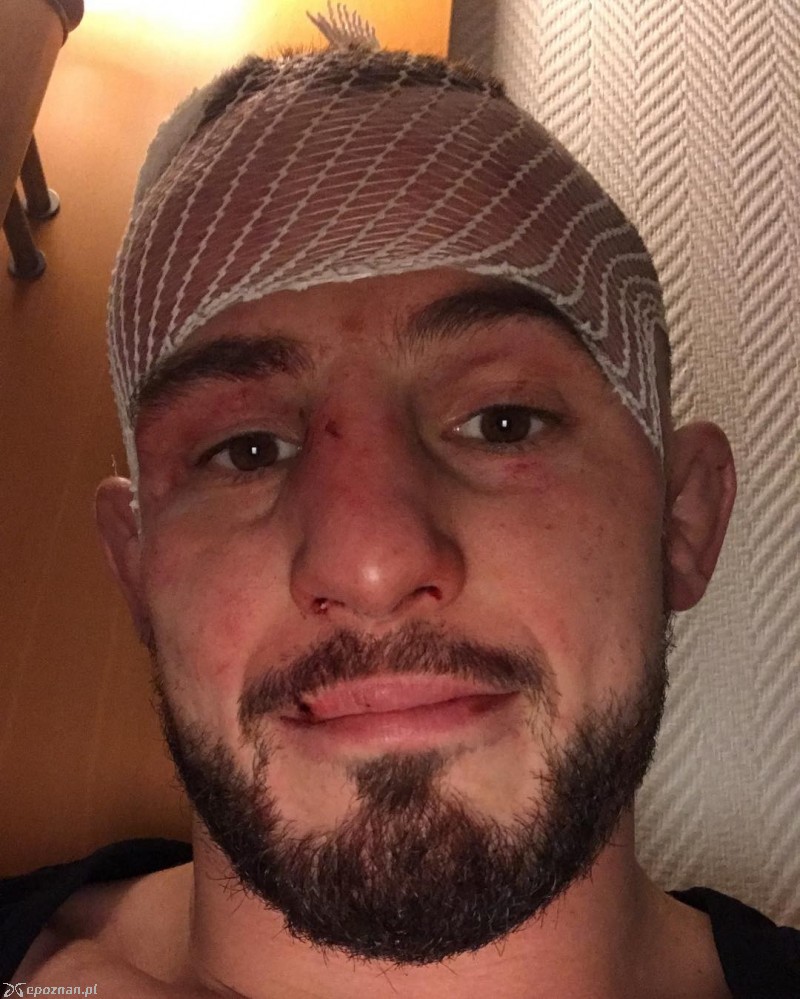 Borys Mańkowski po walce fot. Instagram