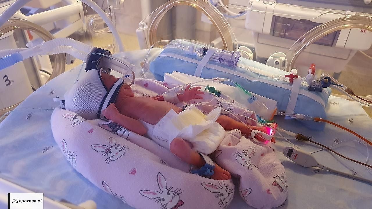 GPSK przy ulicy Polnej | fot. Pierwsze z prezentowanych zdjęć pięcioraczków